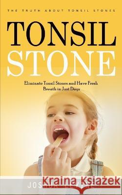 Tonsil Stones: The Truth about Tonsil Stones (Eliminate Tonsil Stones and Have Fresh Breath in Just Days!) Joshua Levine   9781990373954 Darby Connor - książka