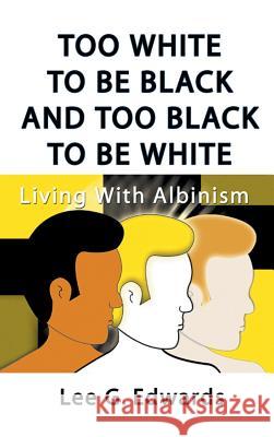 Too White to Be Black and Too Black to Be White: Living with Albinism Edwards, Lee G. 9781588200648 Authorhouse - książka