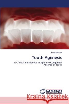 Tooth Agenesis Sharma, Reva 9786208449780 LAP Lambert Academic Publishing - książka