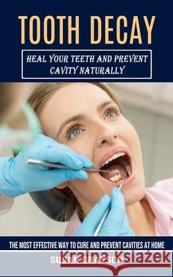 Tooth Decay: Heal Your Teeth and Prevent Cavity Naturally (The Most Effective Way to Cure and Prevent Cavities at Home) Susan Grayson 9781774854518 Darby Connor - książka