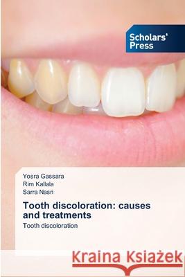 Tooth discoloration: causes and treatments Yosra Gassara Rim Kallala Sarra Nasri 9786206773344 Scholars' Press - książka