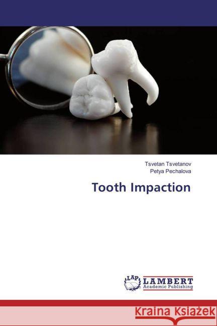 Tooth Impaction Tsvetanov, Tsvetan; Pechalova, Petya 9783659863660 LAP Lambert Academic Publishing - książka