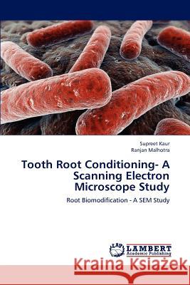 Tooth Root Conditioning- A Scanning Electron Microscope Study Supreet Kaur Ranjan Malhotra 9783846520765 LAP Lambert Academic Publishing - książka