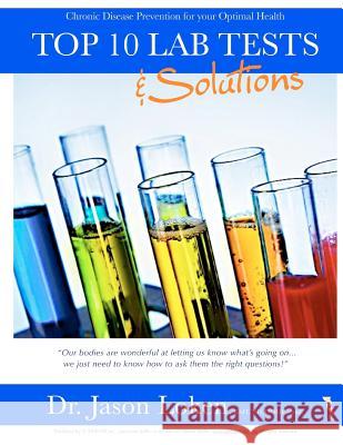 Top 10 Lab Tests and Solutions: Chronic disease prevention for your optimal health Loken Nd, Jason 9781466376991 Createspace - książka