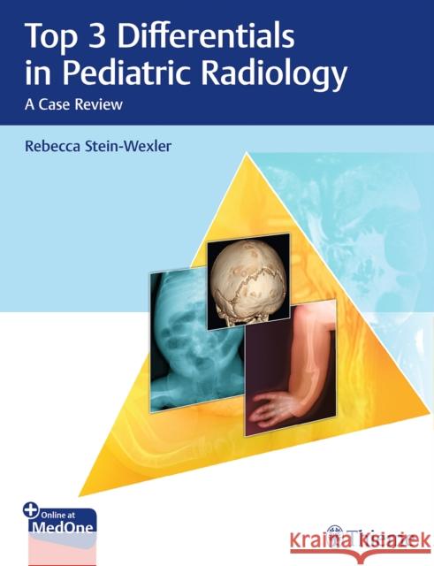 Top 3 Differentials in Pediatric Radiology: A Case Review Stein-Wexler, Rebecca 9781626233706 Thieme Medical Publishers - książka