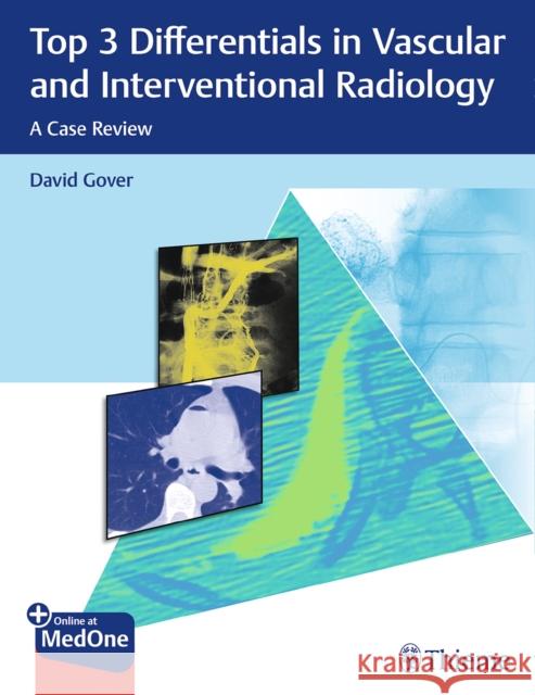 Top 3 Differentials in Vascular and Interventional Radiology: A Case Review Gover, David D. 9781626233560 Thieme Medical Publishers - książka