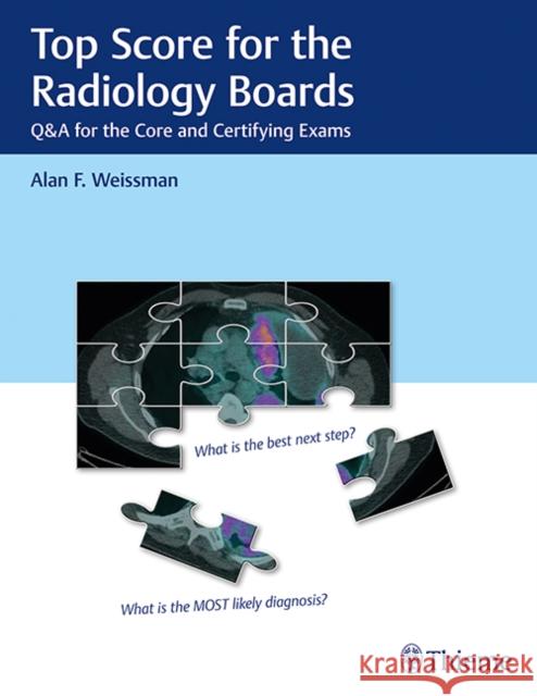 Top Score for the Radiology Boards: Q&A for the Core and Certifying Exams Weissman, Alan 9781626234093 Thieme Medical Publishers - książka
