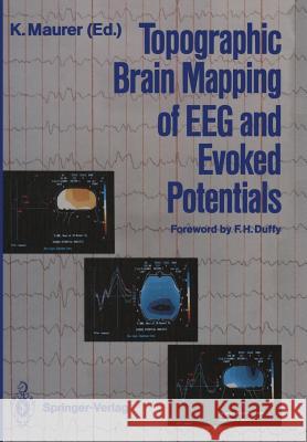 Topographic Brain Mapping of Eeg and Evoked Potentials Duffy, F. H. 9783642726606 Springer - książka