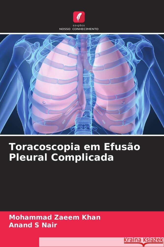 Toracoscopia em Efusão Pleural Complicada Zaeem Khan, Mohammad, S Nair, Anand 9786204774602 Edições Nosso Conhecimento - książka