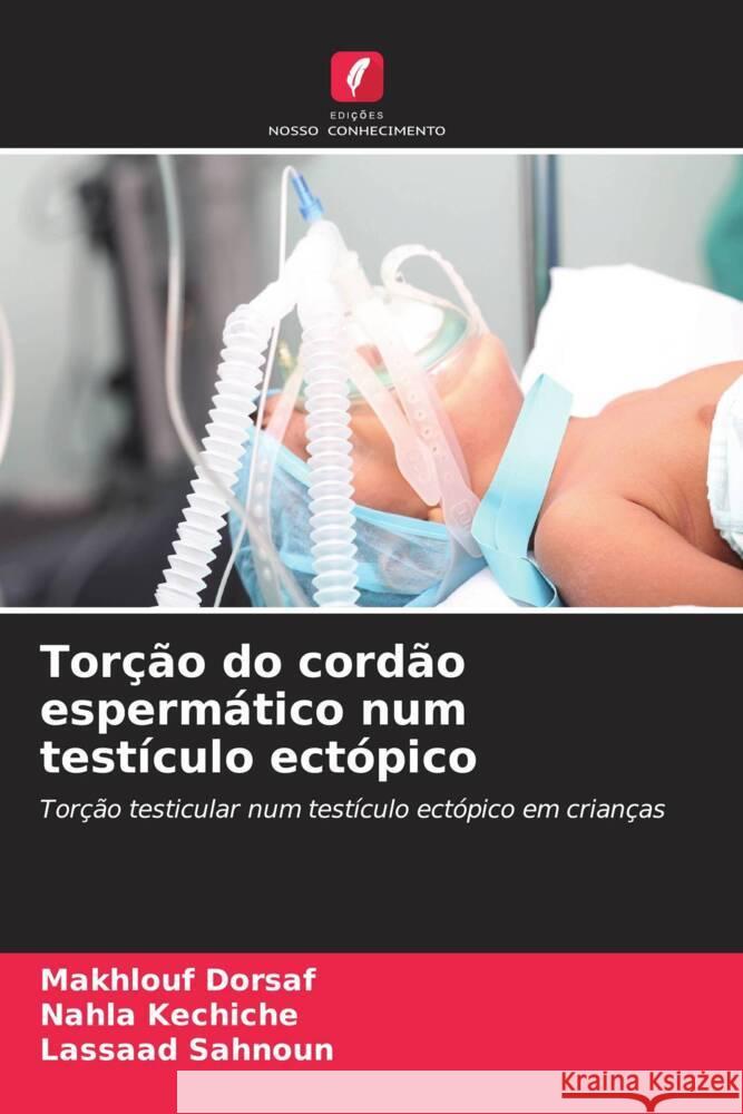 Torção do cordão espermático num testículo ectópico Dorsaf, Makhlouf, kechiche, Nahla, Sahnoun, Lassaad 9786208310721 Edições Nosso Conhecimento - książka