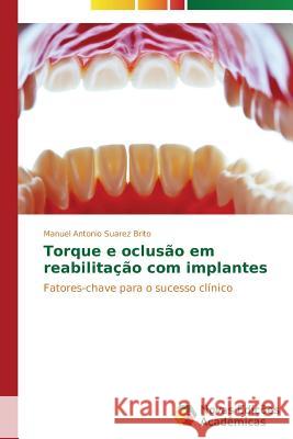 Torque e oclusão em reabilitação com implantes Suárez Brito Manuel Antonio 9783639692457 Novas Edicoes Academicas - książka