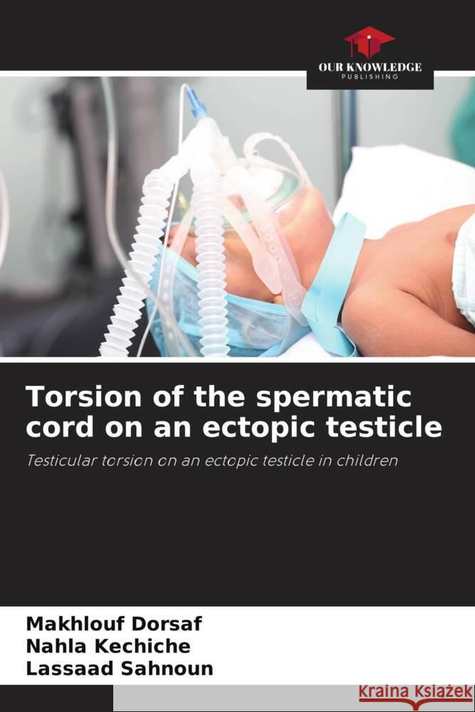 Torsion of the spermatic cord on an ectopic testicle Dorsaf, Makhlouf, kechiche, Nahla, Sahnoun, Lassaad 9786208310684 Our Knowledge Publishing - książka