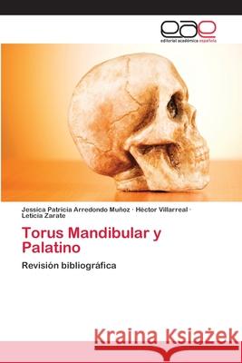 Torus Mandibular y Palatino Arredondo Muñoz, Jessica Patricia 9786202128179 Editorial Académica Española - książka