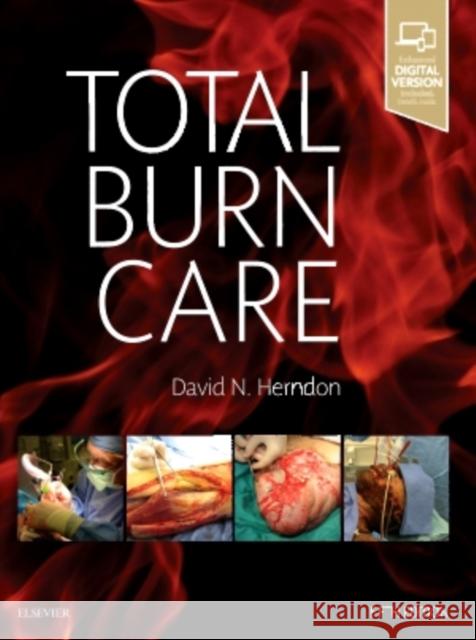 Total Burn Care David N. Herndon 9780323476614 Elsevier - książka