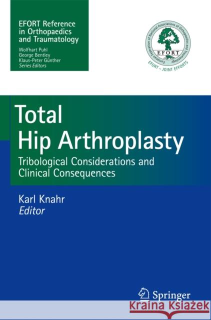 Total Hip Arthroplasty: Tribological Considerations and Clinical Consequences Knahr, Karl 9783642356520  - książka