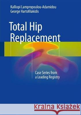 Total Hip Replacement: Case Series from a Leading Registry Lampropoulou-Adamidou, Kalliopi 9783319533599 Springer - książka