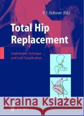 Total Hip Replacement: Implantation Technique and Local Complications Hinchliffe, R. 9783540438762 Springer - książka