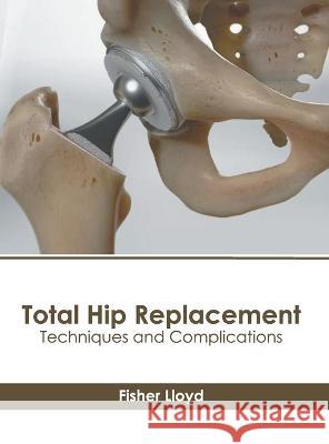 Total Hip Replacement: Techniques and Complications Fisher Lloyd 9781639895267 States Academic Press - książka