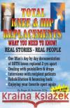 Total knee & hip replacement: What you need to know Breternitz, Roger W. 9781530728558 Createspace Independent Publishing Platform