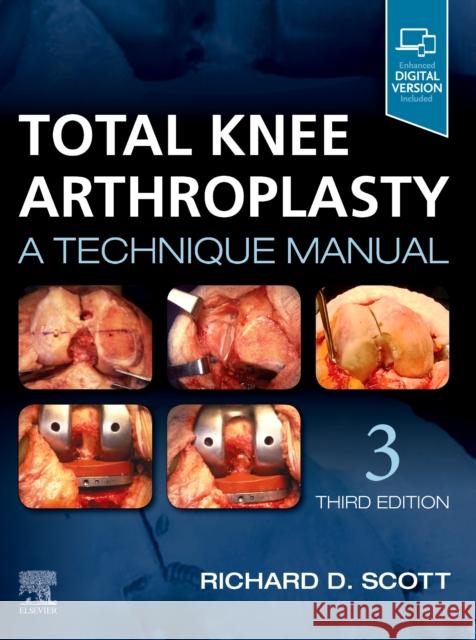 Total Knee Arthroplasty: A Technique Manual Richard D. Scott 9780323710657 Elsevier - książka
