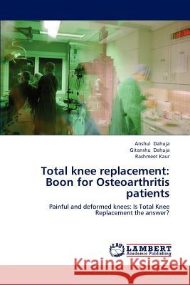 Total knee replacement: Boon for Osteoarthritis patients Dahuja, Anshul 9783659192579 LAP Lambert Academic Publishing - książka