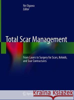Total Scar Management: From Lasers to Surgery for Scars, Keloids, and Scar Contractures Ogawa, Rei 9789813297906 Springer - książka