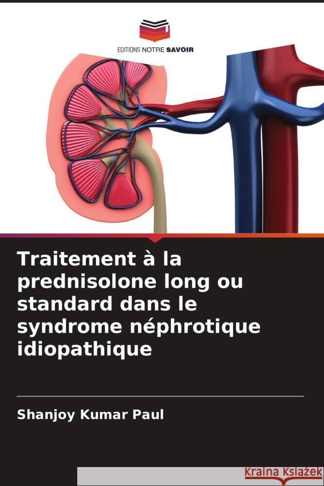 Traitement ? la prednisolone long ou standard dans le syndrome n?phrotique idiopathique Shanjoy Kumar Paul 9786207981991 Editions Notre Savoir - książka