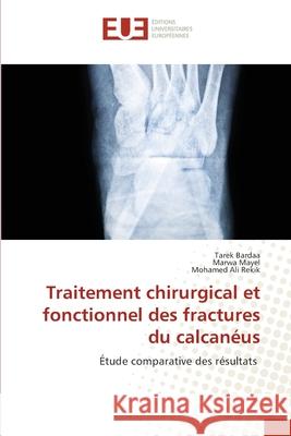 Traitement chirurgical et fonctionnel des fractures du calcanéus Bardaa, Tarek 9786203425536 Editions Universitaires Europeennes - książka