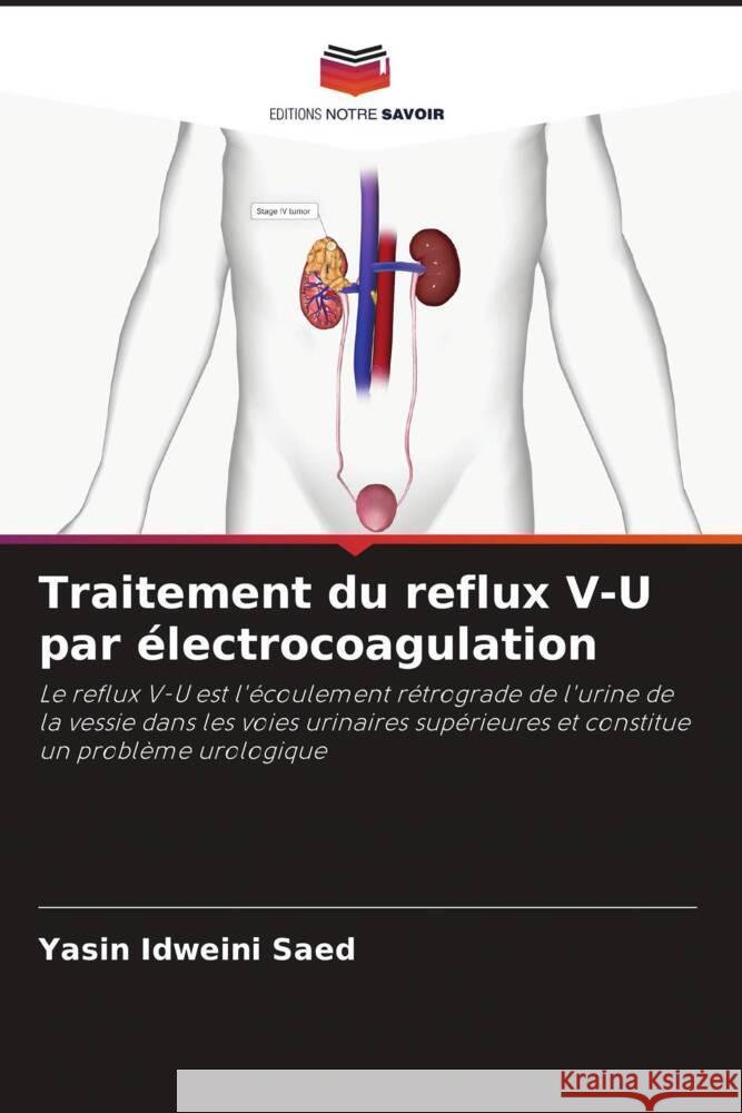 Traitement du reflux V-U par ?lectrocoagulation Yasin Idweini Saed 9786206879565 Editions Notre Savoir - książka