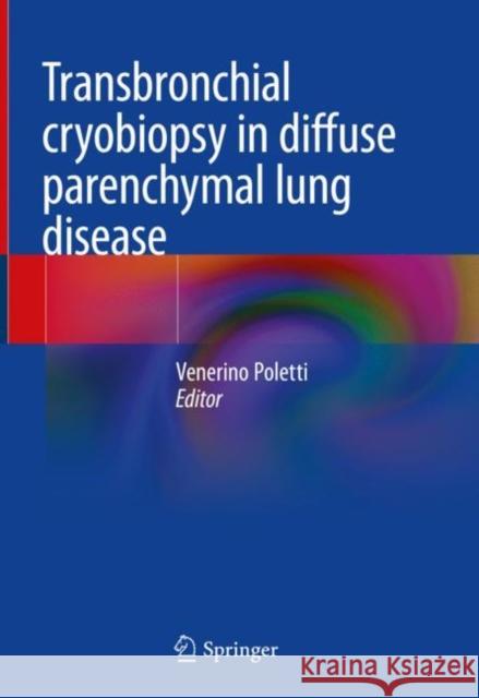 Transbronchial Cryobiopsy in Diffuse Parenchymal Lung Disease Poletti, Venerino 9783030148904 Springer - książka