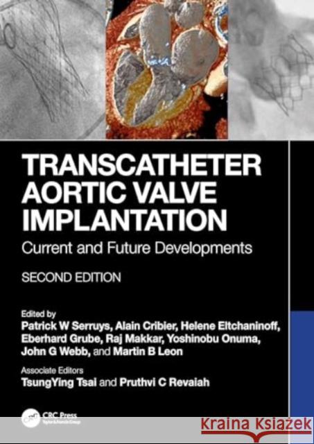 Transcatheter Aortic Valve Implantation: Current and Future Developments Patrick W. Serruys Alain Cribier Helene Eltchaninoff 9781032471471 CRC Press - książka