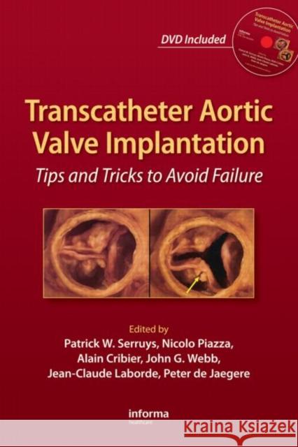 Transcatheter Aortic Valve Implantation: Tips and Tricks to Avoid Failure [With DVD] Serruys, Patrick W. 9781841846897 Informa Healthcare - książka