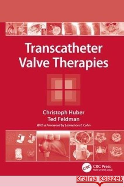 Transcatheter Valve Therapies Christoph Huber Ted Feldman (Evanston Hospital, Illinois  9781138116108 CRC Press - książka
