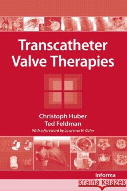 Transcatheter Valve Therapies Christoph Huber 9781439810781 Informa Healthcare - książka