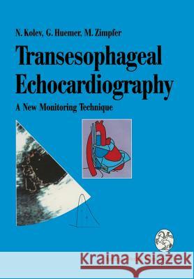 Transesophageal Echocardiography: A New Monitoring Technique N. Kolev Nikolai Kolev Ga1/4nter Huemer 9783211826508 Springer - książka