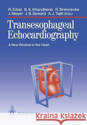 Transesophageal Echocardiography: A New Window to the Heart Erbel, Raimund 9783642742590 Springer - książka