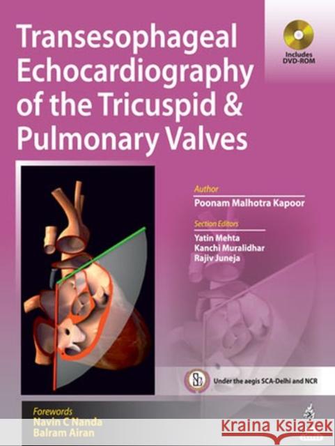 Transesophageal Echocardiography of the Tricuspid & Pulmonary Valves Poonam Malhotra Kapoor   9789351521297 Jaypee Brothers Medical Publishers - książka