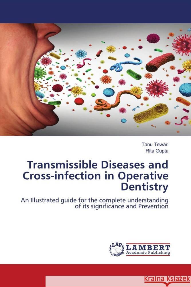 Transmissible Diseases and Cross-infection in Operative Dentistry Tewari, Tanu, Gupta, Rita 9786204956480 LAP Lambert Academic Publishing - książka