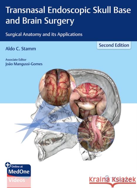 Transnasal Endoscopic Skull Base and Brain Surgery: Surgical Anatomy and Its Applications Stamm, Aldo C. 9781626237100 Thieme Medical Publishers - książka