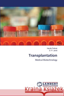 Transplantation Hardik Pathak D. P. Jaroli 9783659188923 LAP Lambert Academic Publishing - książka