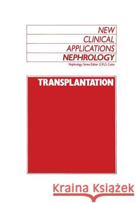 Transplantation G. R. Catto 9789401068727 Springer - książka