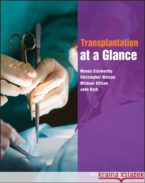 Transplantation at a Glance Menna Clatworthy 9780470658420 WILEY-BLACKWELL - książka