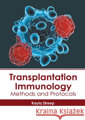 Transplantation Immunology: Methods and Protocols Kayla Streep 9781632418692 Hayle Medical - książka