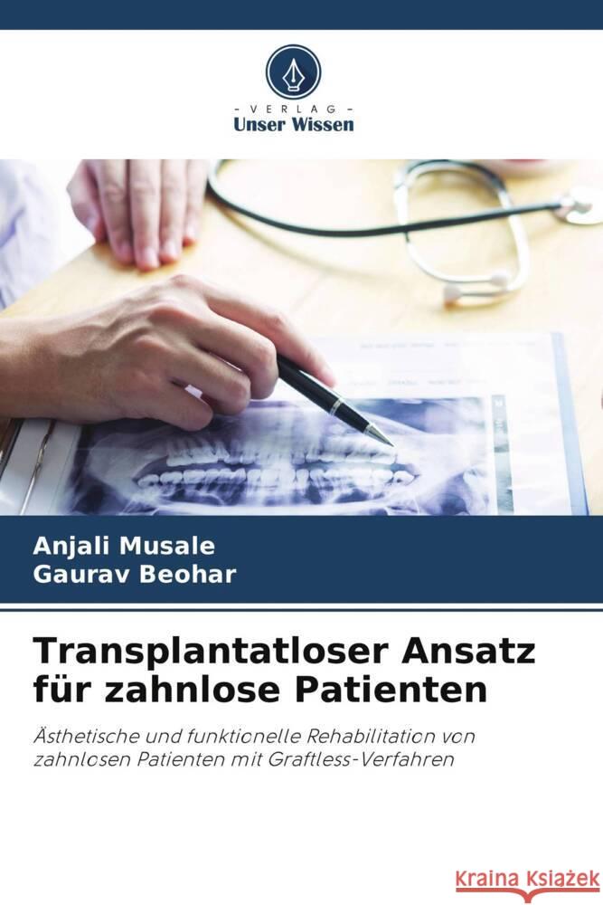 Transplantatloser Ansatz für zahnlose Patienten Musale, Anjali, Beohar, Gaurav 9786208570866 Verlag Unser Wissen - książka