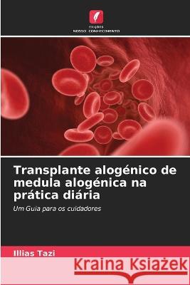 Transplante alog?nico de medula alog?nica na pr?tica di?ria Illias Tazi 9786205870372 Edicoes Nosso Conhecimento - książka