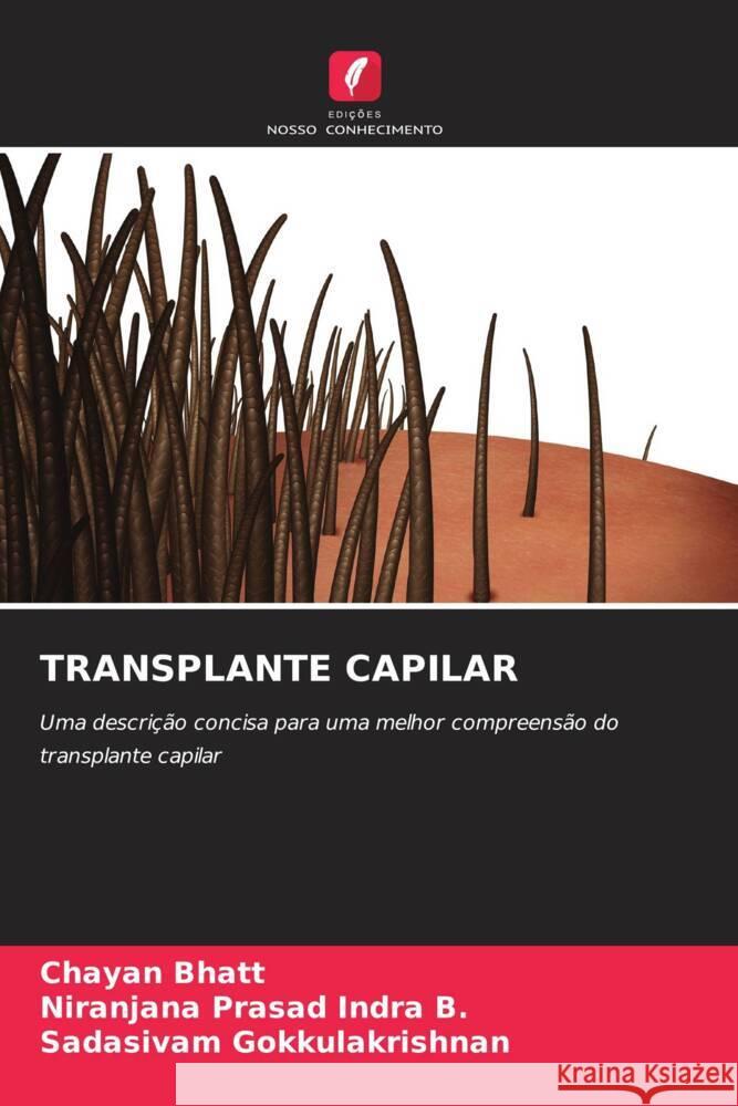 TRANSPLANTE CAPILAR Bhatt, Chayan, Indra B., Niranjana Prasad, Gokkulakrishnan, Sadasivam 9786206273585 Edições Nosso Conhecimento - książka