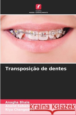 Transposição de dentes Bhale, Anagha, Sabane, Anand, Changediya, Riya 9786209695049 Edições Nosso Conhecimento - książka