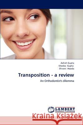 Transposition - a review Gupta, Ashish 9783659189166 LAP Lambert Academic Publishing - książka