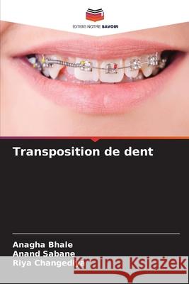 Transposition de dent Bhale, Anagha, Sabane, Anand, Changediya, Riya 9786209689925 Editions Notre Savoir - książka