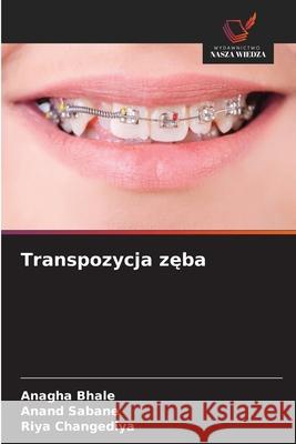 Transpozycja zeba Bhale, Anagha, Sabane, Anand, Changediya, Riya 9786209697609 Wydawnictwo Nasza Wiedza - książka